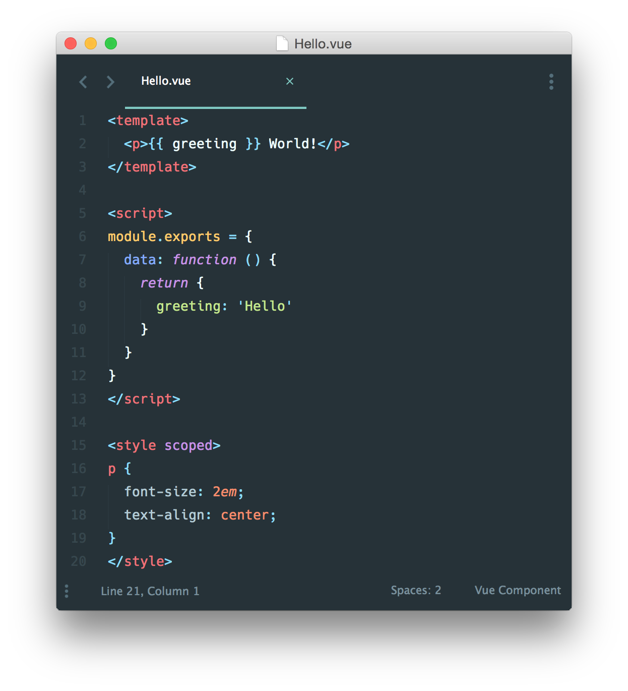 Vue.js、vue安装步骤、单文件组件、模板指令_ 图片描述
